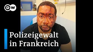 Polizeigewalt-Video schockiert Frankreich | DW Nachrichten