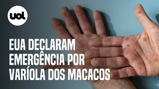 Varíola do macaco: EUA declaram emergência sanitária