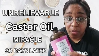 I Used CASTOR OIL For 30 DAYS And THIS HAPPENED!