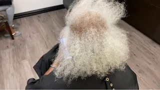 Alopecia Transformation | She hasn’t worn her hair in 5 years !