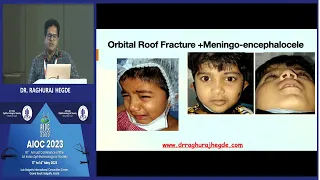 AIOC 2023 IC459 topic DR  RAGHURAJ HEGDE Imaging for orbital implants and its implications