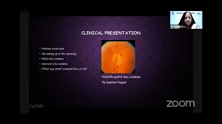 Ischemic optic neuropathies - An overview