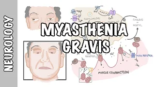 Myasthenia Gravis - symptoms, pathophysiology, investigations, treatment