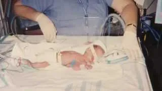 Patient Story: Neonatal Intensive Care Unit (Marsha Liss)