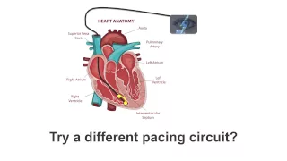 Pacemaker Issues Explained (Part 4): Expert Troubleshooting Tips