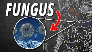 There's fungus in your gut (surprise!) | Ep111