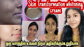 Magical Skin transformation whitening cream/ gayus lifestyle