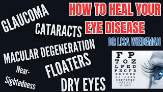 Change Your Diet & HEAL YOUR EYES...Dry Eye/Cataracts/Macular Degeneration & MORE!