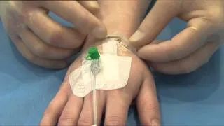 3M™ Tegaderm™ Transparent I.V. Dressing, 1633 Application and Removal