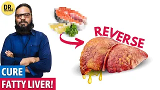 Fatty Liver Ka Qudrati Ilaj (Jigar Ki Charbi) Reverse Fatty Liver Naturally | Dr. Ibrahim