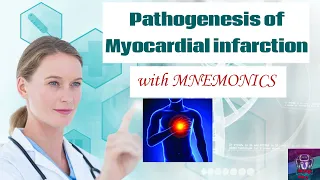 Pathogenesis of Myocardial infarction (MI) with MNEMONICS