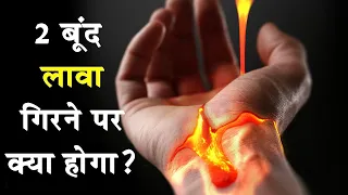 लावा गिरने के बाद आपके शरीर का क्या होगा|What If 2 Drops of Lava Fell On Your Body?|Volcano facts