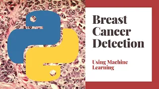 Breast Cancer Detection Using Python & Machine Learning