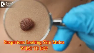 SKIN MOLES LOOKING SUSPICIOUS!!! What to do? Should I monitor? -Dr. Urmila Nischal | Doctors' Circle