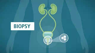 Prostate Biopsy: What You Should Know - Urology Care Foundation