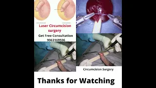 laser circumcision treatment in hyderabad #hospital #hyderabad
