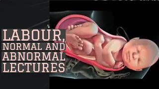 LABOUR lecture 9 CEPHALOPELVIC DISPROPORTION, Malpresentation, abnormalities of birth canal made sim