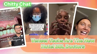 Chitty Chat| Let’s Chat About These Veneer Techs