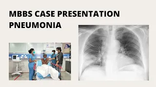 MBBS Case Presentation || Pneumonia