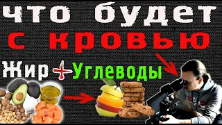 Жир + углеводы. Что будет с кровью под микроскопом?