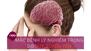 Suy tuyến yên: Hiểu đúng để sống khoẻ | VTC Now