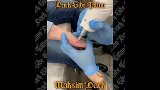 Удаление тату. Студия «Dark Side Tattoo» г. Воронеж