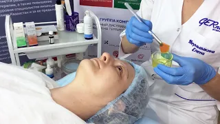 Block Age Peel Gel