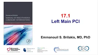 17.1 Left main PCI: Manual of PCI