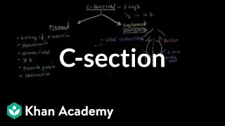 C-section | Reproductive system physiology | NCLEX-RN | Khan Academy