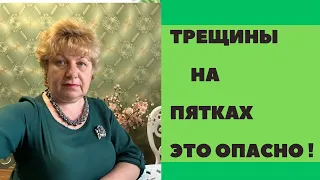 Трещины на пятках ? Лучшие советы !