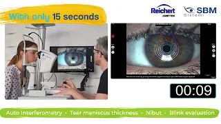 Idra Comprehensive Dry Eye Assessment - Video Brochure - Reichert AMETEK Eye Care | SBM