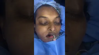 Giant cheek and face swelling tumor removed by Plasticsurgery