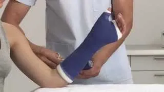 Plaster of Paris Scaphoid Splint Application