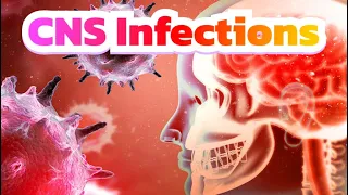 Meningitis and CNS Infections (updated 2023) - CRASH! Medical Review Series