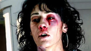 This is what a giant spider bite does in Cloverfield