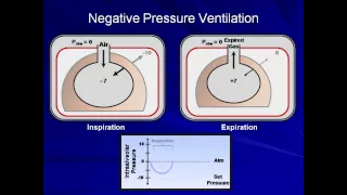 An Introduction to Mechanical Ventilation (Mechanical Ventilation - Lecture 1)