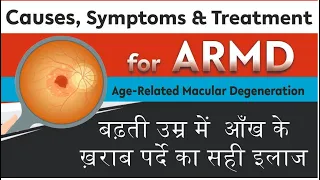 What is Age Related Macular Degeneration ? | AMD Treatment | बढ़ती उम्र में आँख के ख़राब पर्दे का इलाज