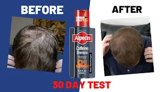 I used "Alpecin Caffeine Shampoo" for 30 days. Here's what happened...