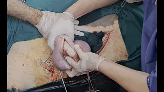 Cesarean delivery in cow 🐄 Césarienne 🐄 Kaiserschnitt 🐄 Cesárea 🐄 Cesáriana 🐄 Cesarskie cięcie 🐄