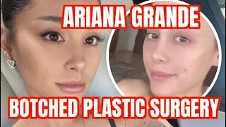 Ariana Grande Plastic Surgery Drama