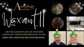 DEEP, DRY & IMPACTED EAR WAX REMOVAL - EP696