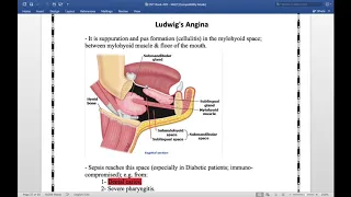 Chapter 5 Ludwig’s Angina