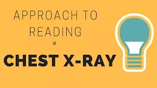 How to Read a Chest Xray? - A simple approach