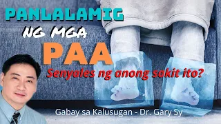 COLD FEET (Panlalamig ng mga Paa) - Dr. Gary Sy