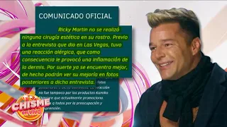 RICKY MARTIN habla de su nueva CARA totalmente DEFORME | Chisme en Vivo