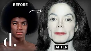 How Much Plastic Surgery Did Michael Jackson Actually Have?!! | the detail.