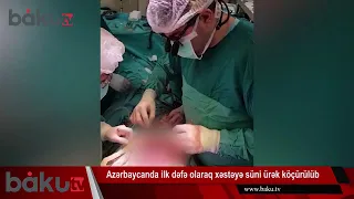 В Азербайджане впервые имплантировали искусственное сердце   ФОТО ВИДЕО