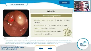 Crup y Bronquiolitis