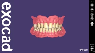 exocad Video Tutorial: Full Denture Design