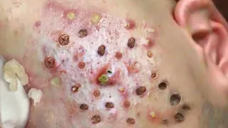 Most Satisfying and Relaxation with An Spa Video #9897